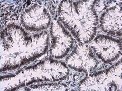 Immunohistochemistry-Paraffin: Rad17 [p Ser656] Antibody [NBP3-13072]